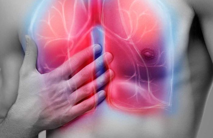 Pulmonology